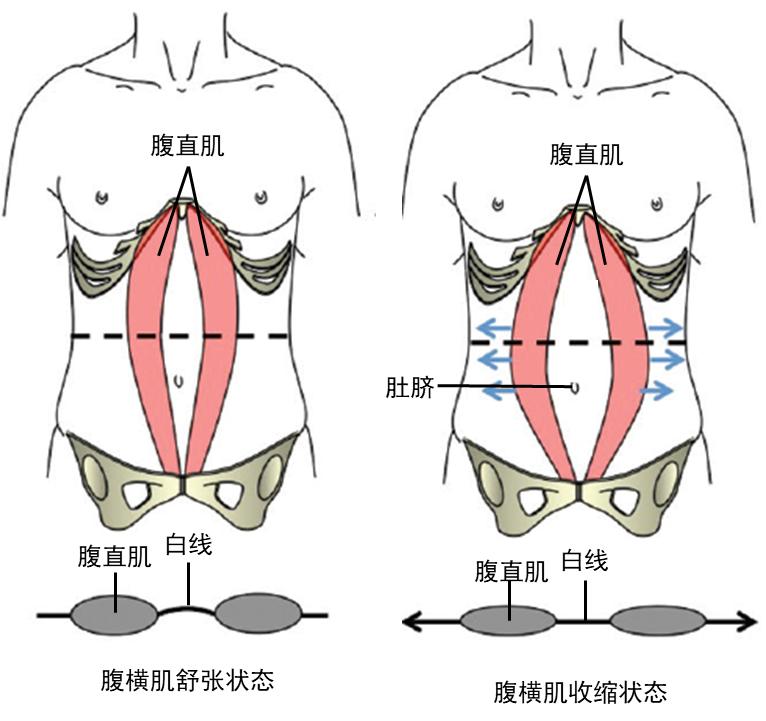 腹横肌3.jpg